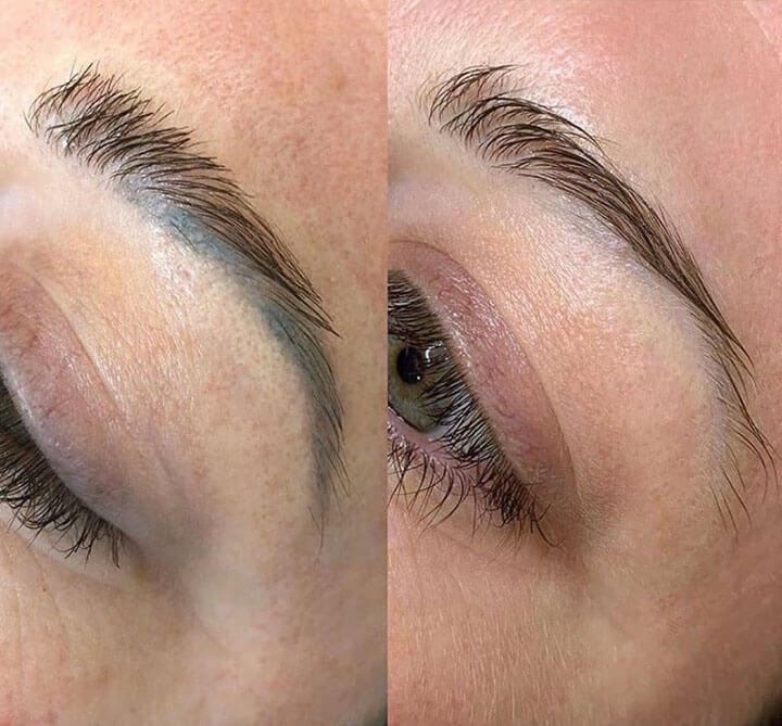 Eliminación de Tatuaje en Cejas con Láser LISALASH STUDIO Houston