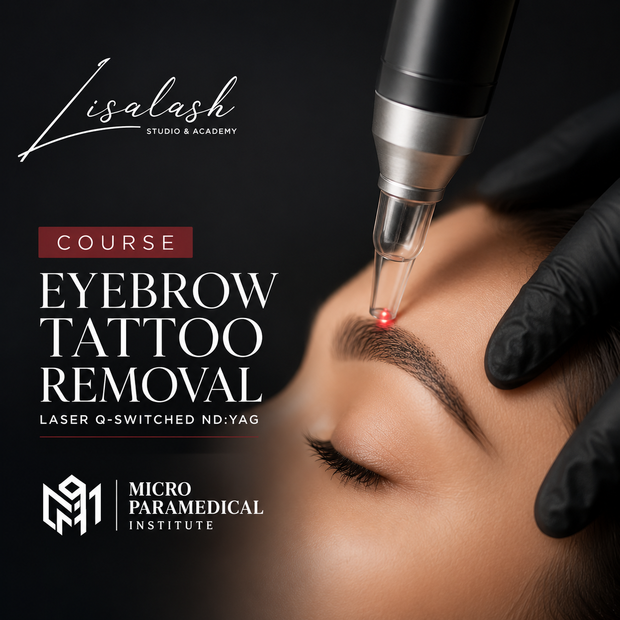 Curso Láser y Hollywood Peeling
