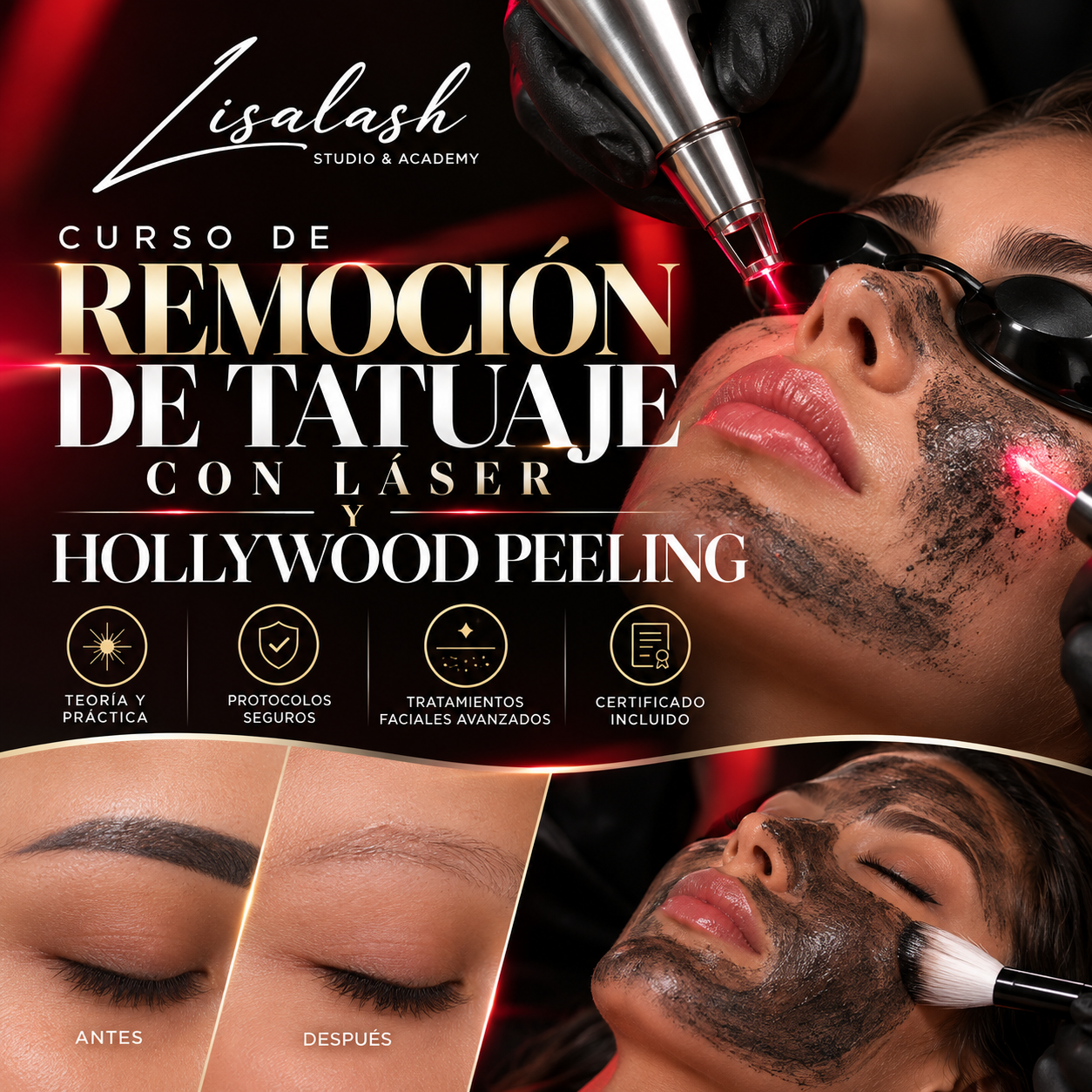 Curso Láser y Hollywood Peeling
